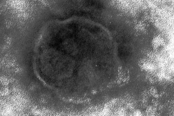 🚨 Japão em alerta: Sarampo dispara e preocupa autoridades